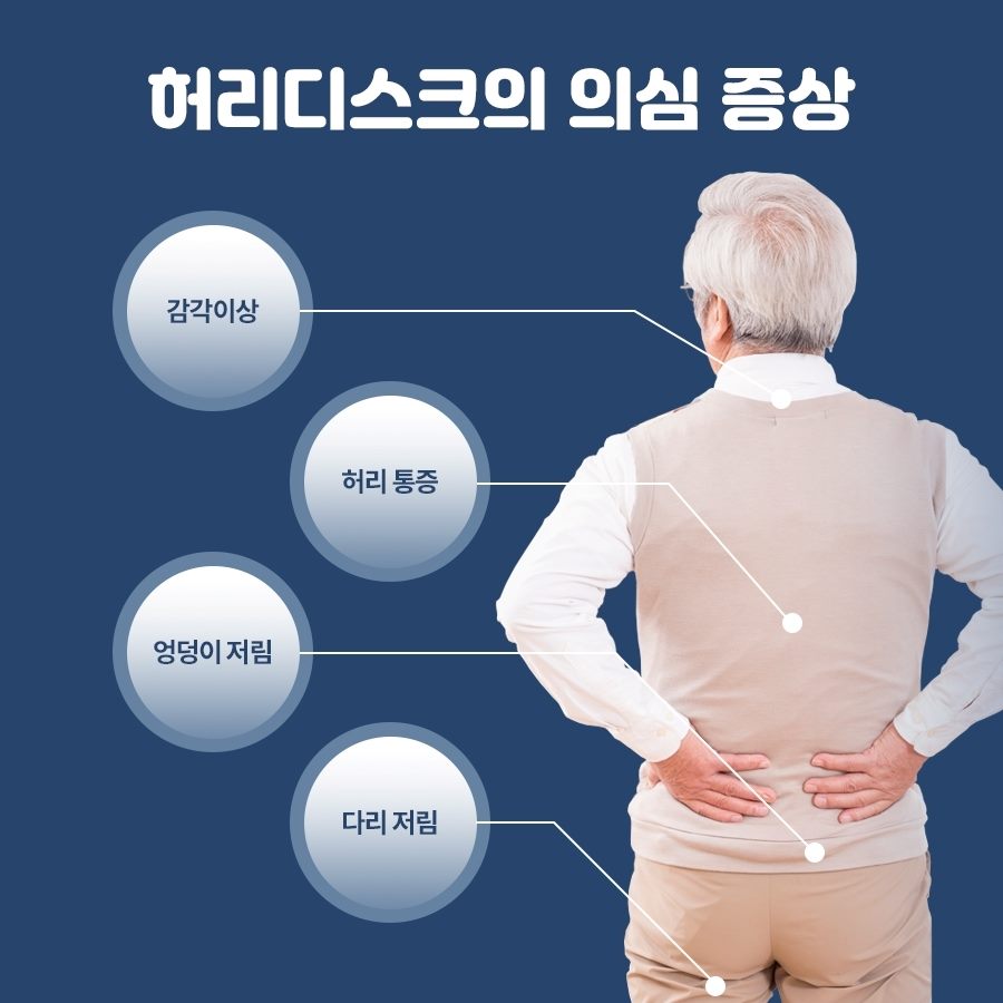 허리디스크의 의심 증상: 감각이상, 허리통증, 엉덩이 저림, 다리 저림