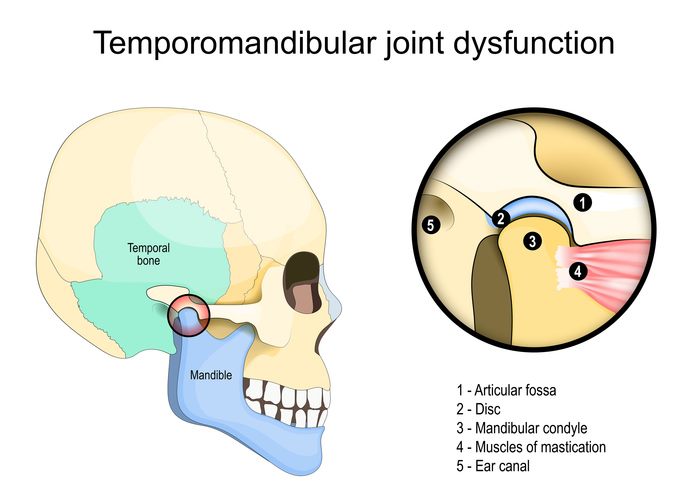 턱관절(TMJ) 구조: 관절와, 디스크, 하악 과두, 저작근, 외이도